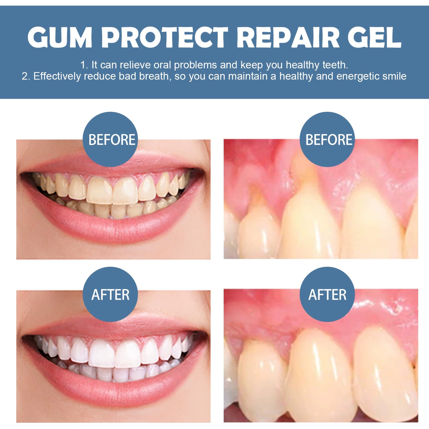 ✨ Gum Repair Gel | Professional Gum Regeneration Gel