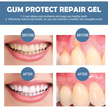 ✨ Gum Repair Gel | Professional Gum Regeneration Gel